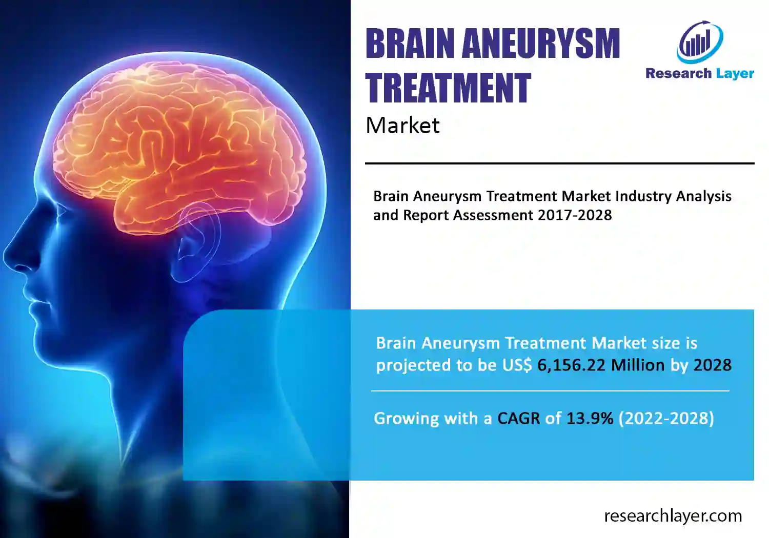 Brain Aneurysm Treatment Market